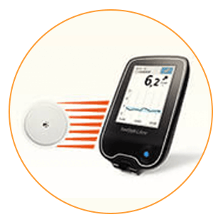 雅培瞬感掃描儀