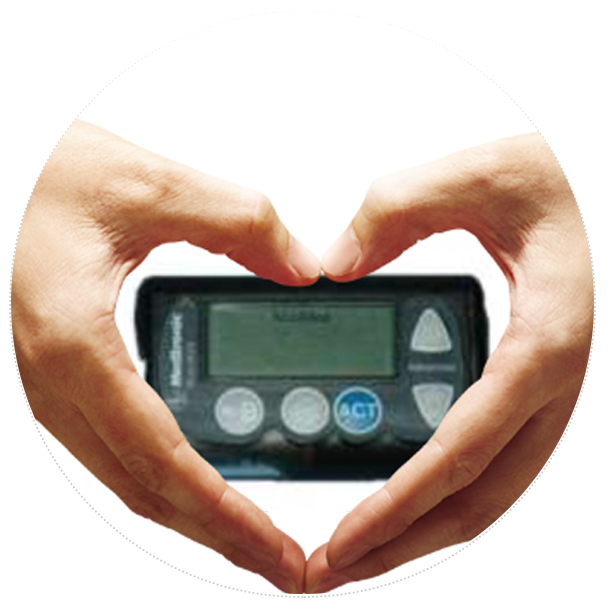 美敦力易泵胰島素泵