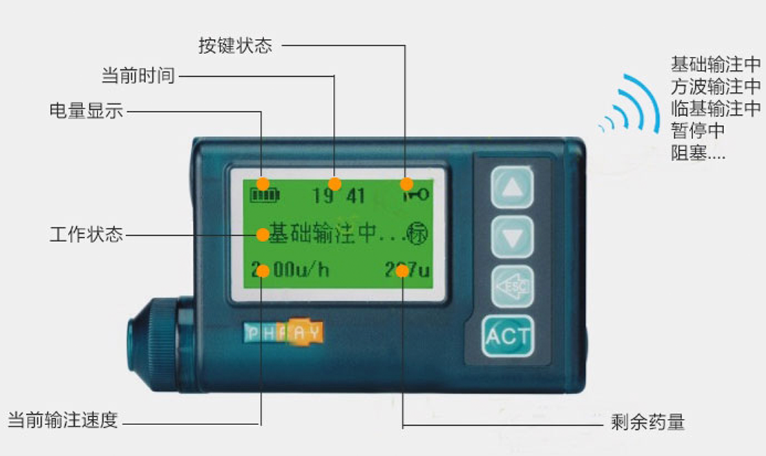 優(yōu)泵PH300胰島素泵產(chǎn)品信息